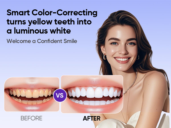 Teeth Whitening Strips