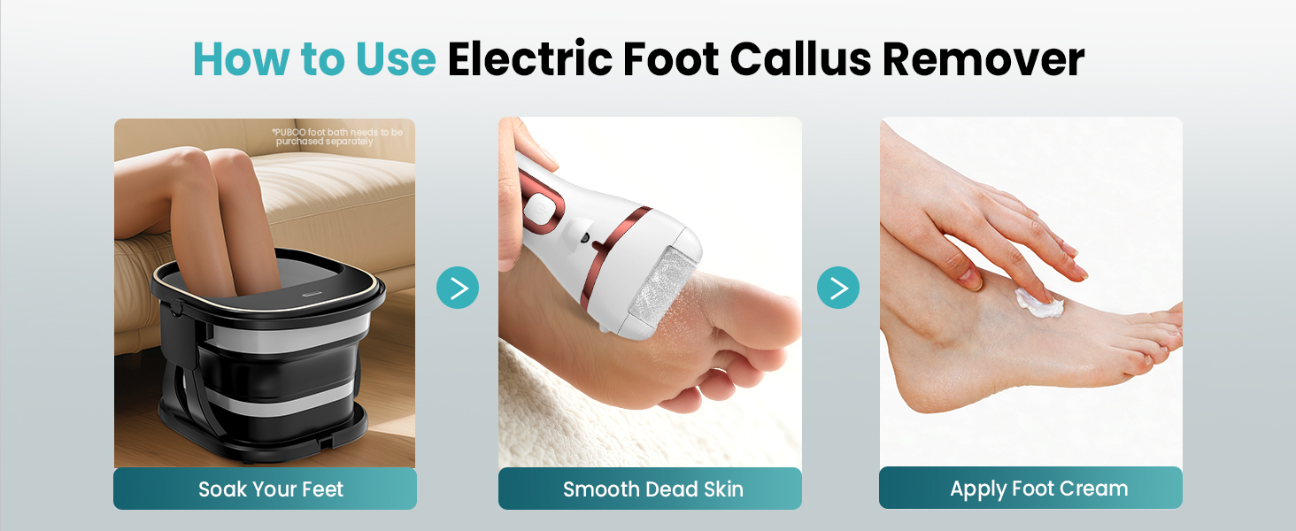 foot heel callus remover