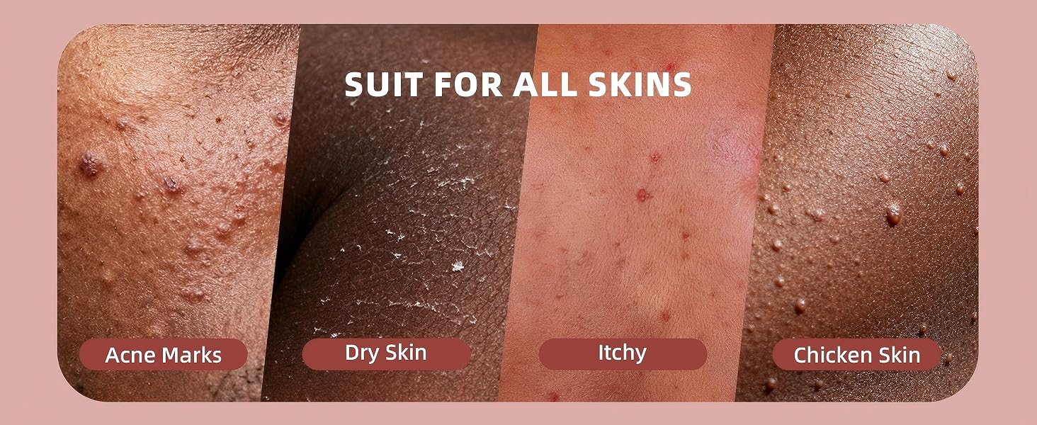 Suit for All Skins