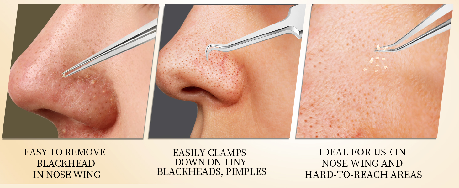 pimple tweezers