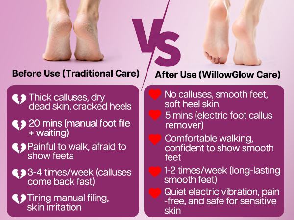 pain-free electric callus removal for long-lasting smooth feet.
