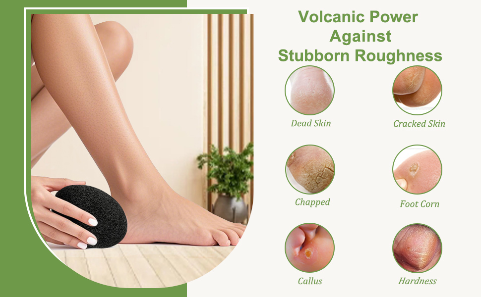 foot callus remover, foot pumice