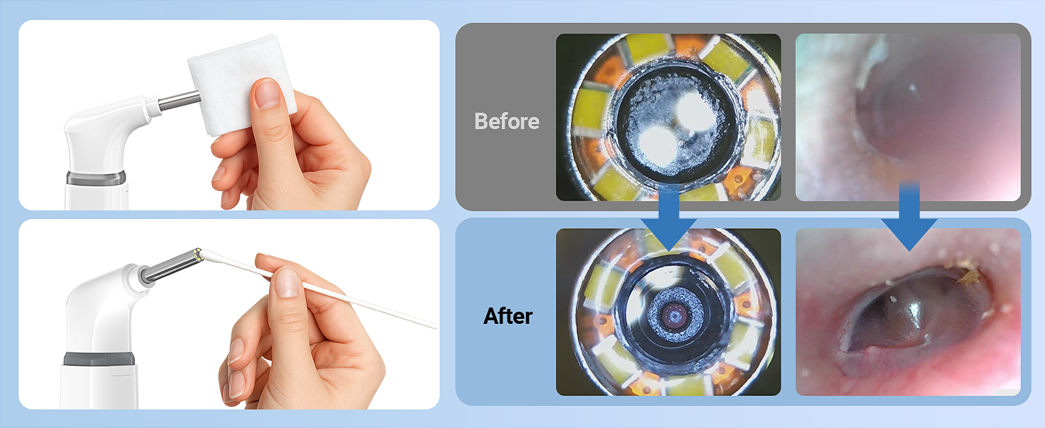 Otoscope with Light Ear Camera Ear Scope Otoscope Camera