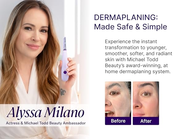Dermaplaning before and after results for smooth radiant skin and peach fuzz removal