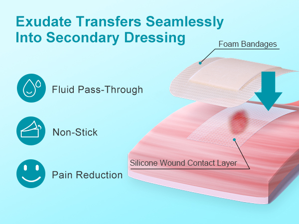 wound dressing