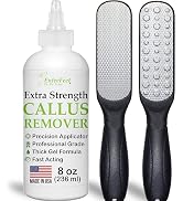 Callus Remover Gel & Double-Sided Foot File: 8 oz Extra Strength Callus Remover for Feet, Foot Ca...