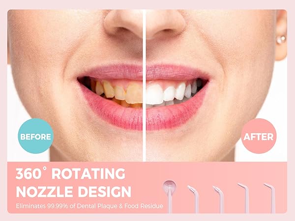 irrigador dental
