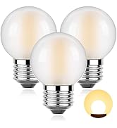 Sphoon Dimmable LED 4W Globe Light Bulb,40W Equivalent E26 Standard Screw Base Small Decorative B...