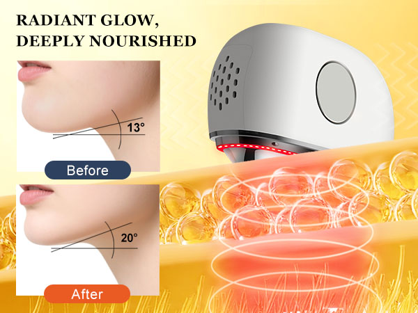 Red Light reaches deep into muscle tissue, relax facial tension and support natural contours