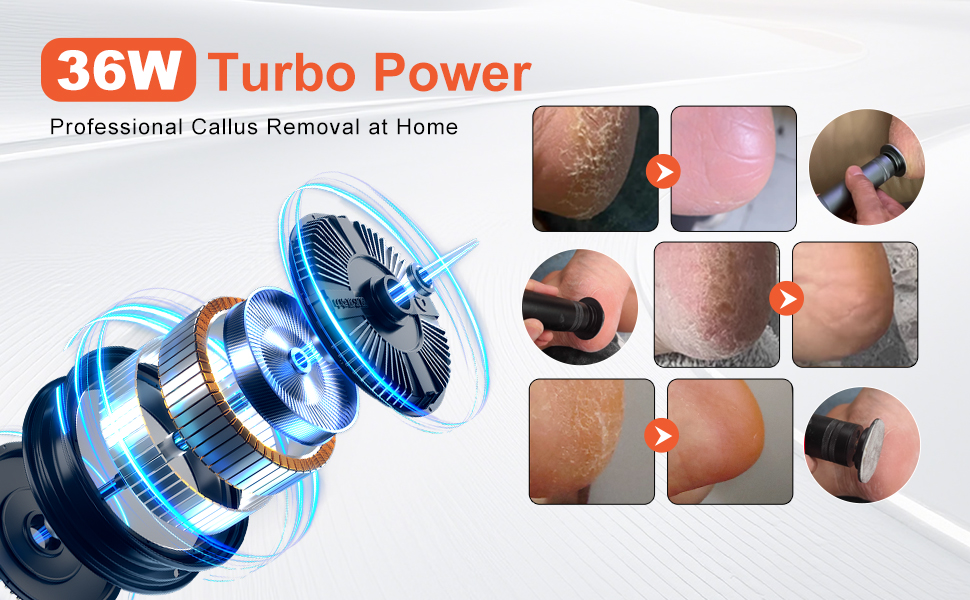 36W powerful motor electric foot callus remover professional callus removal tool home use