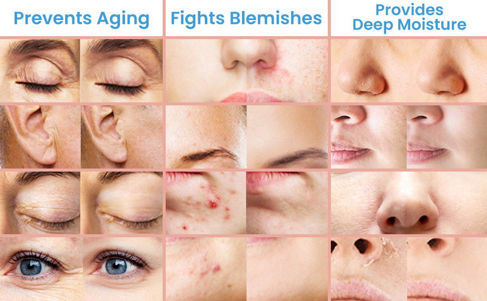 prevents aging, fights blemishes, provides deep moisture