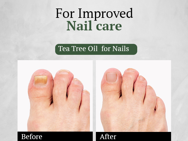 Tea Tree Oil for nails