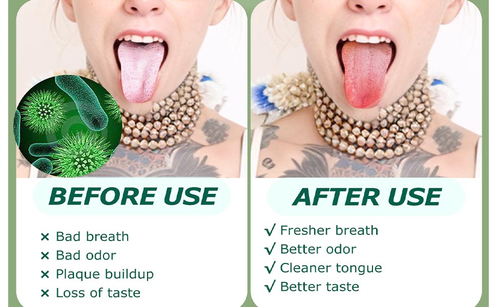 tongue scraper disposable