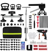 ROADGIVE 100PCS Paintless Dent Repair Kit Professional, DIY Body Repair Dent Removal Tools with B...