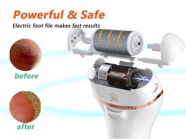 callus remover for feet professional