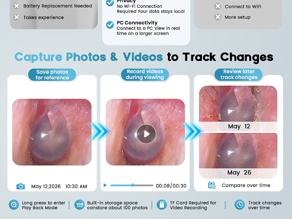 Otoscope