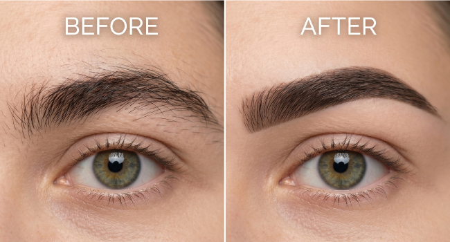 Get the Flawless Results