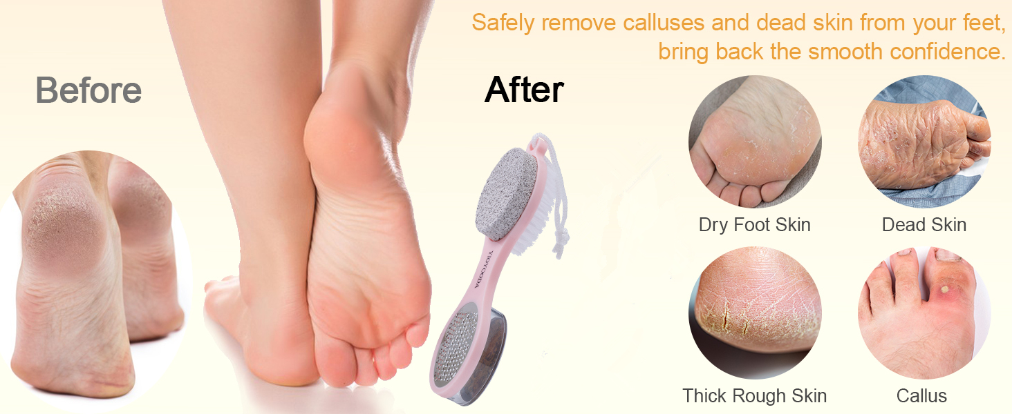 Foot Scrubber Brush with Pumice Stone for Feet, 5-in-1