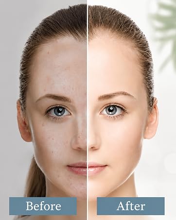 whitehead remover
