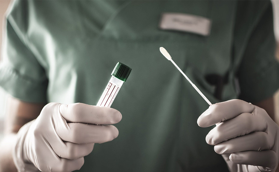 sterile cotton swabs