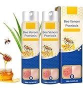 cuoct 2 PCS PsoriaHeal Bee Venom Psoriasis Treatment Spray, Psoriasis Relief Spray, Bee Venom Pso...