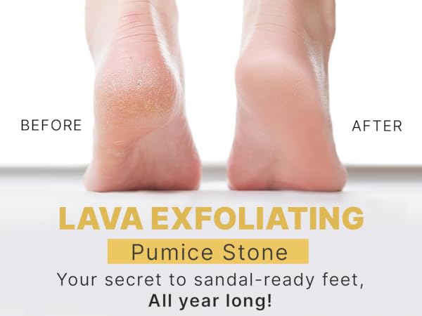 pumice stone feet heavy callused hand callus remover pumustone pumas scrubber piedra pomez pies