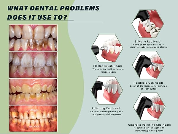dental kit oral care tools