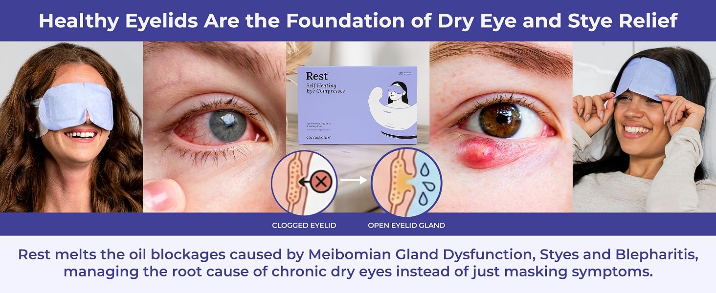 Meibomian gland dysfunction treatment clogged oil gland eye mask blepharitis relief therapy pads