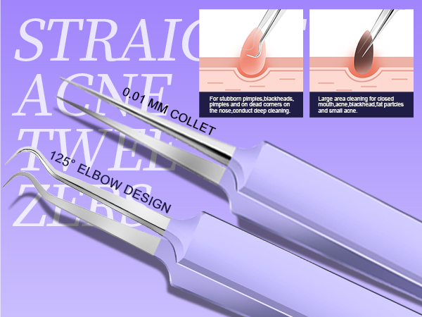 Blackhead Extractor