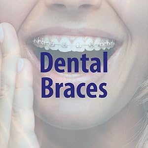 Dental Braces