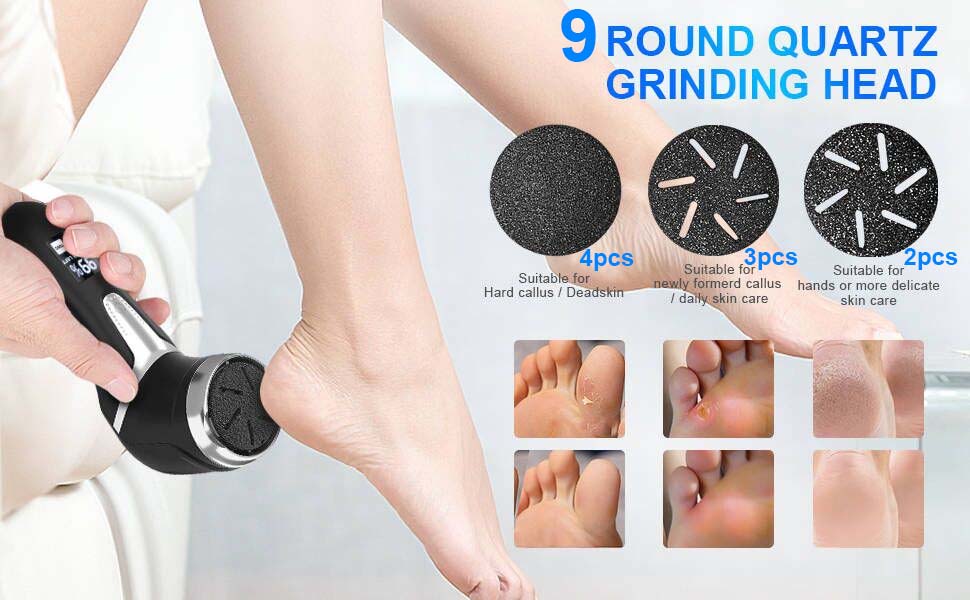 foot callus remover