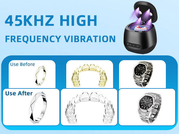 ultrasonic dental retainer cleaner