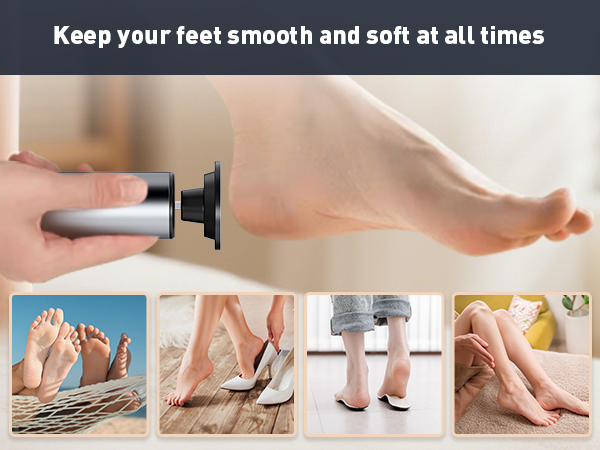 foot callus remover tool electric