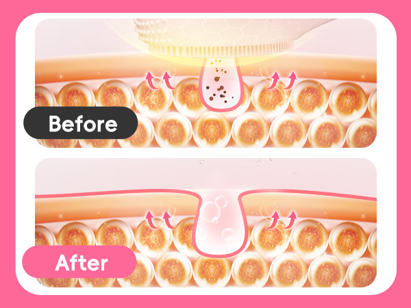 facial scrub brush