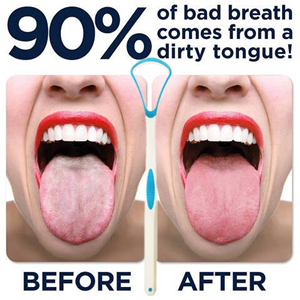 tongue helper remove