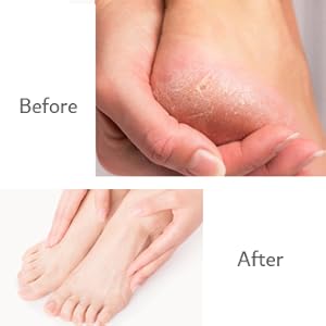 Cleaning and protection