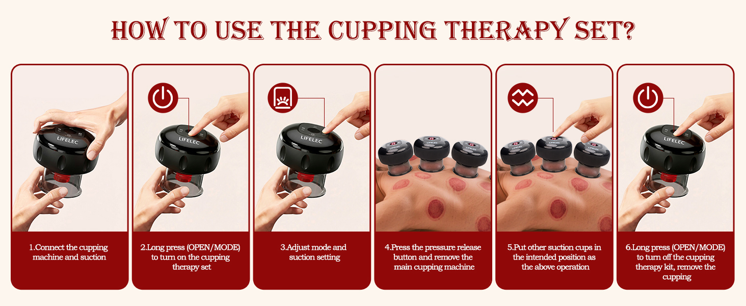 cupping set