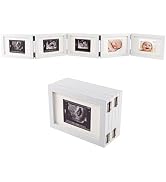 5 Folding Sonogram Picture Frame for Expecting Parents- 4.7" × 6.8" Baby Ultrasound Picture Frame...