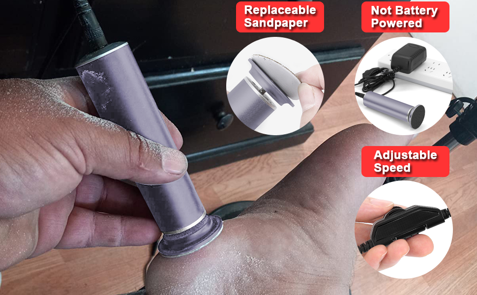 electric callus remover