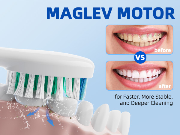SEIGA Sonic Electric Toothbrush for Adults_07