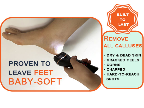 feet callus remover