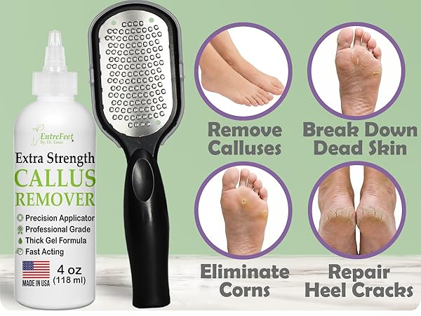 foot callus remover