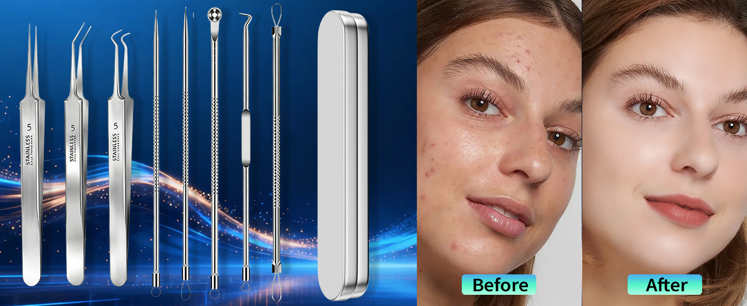 Blackhead remover
