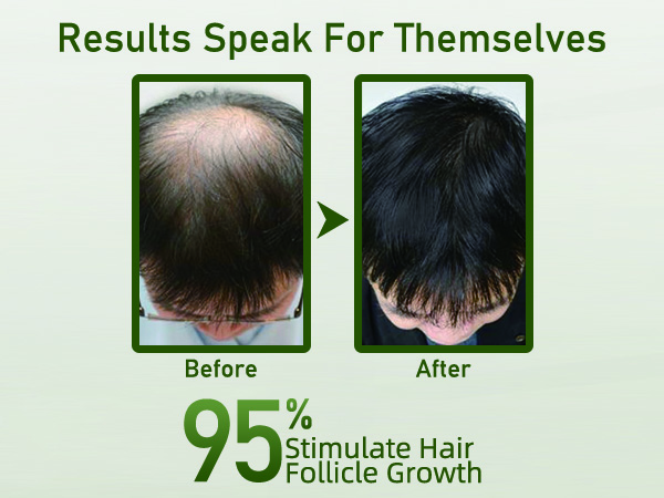 Rosemary Shampoo for Hair Growth