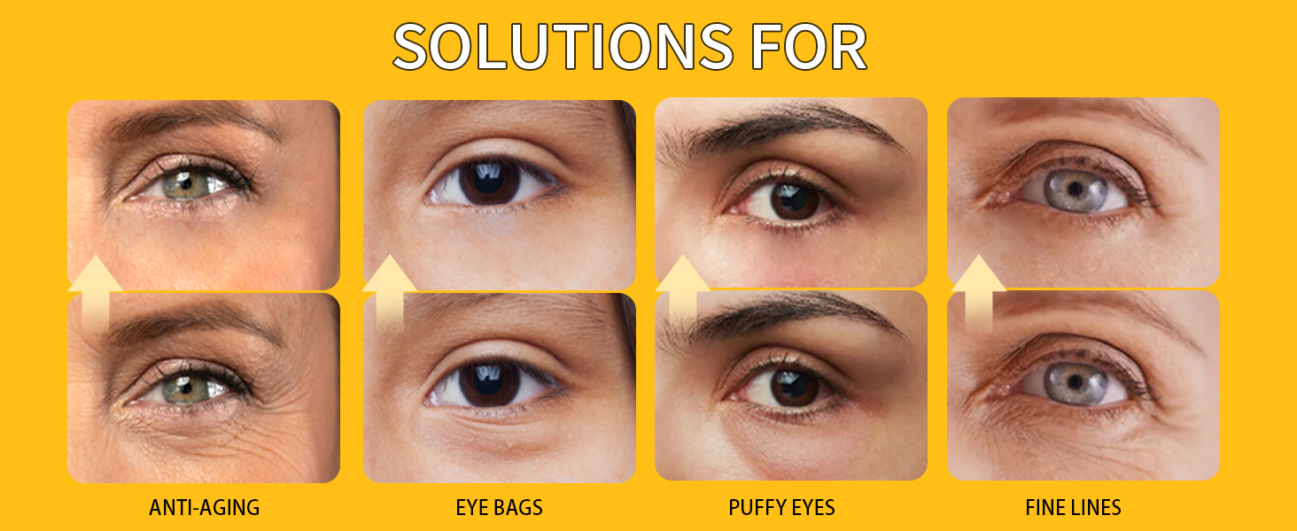 Eye Bags Treatment Eye Mask Skincare Under Eye Gel Pads anti wrinkle hydrogel eye patches