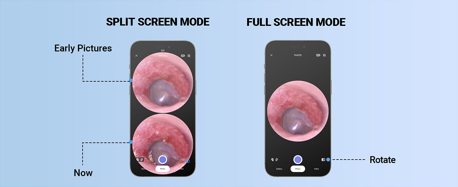 Otoscope with Light Ear Camera Ear Scope Otoscope Camera