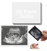 Easy Insert Photo Protector for 3x4in Ultrasound Pictures - Side-Loading to Keep Baby Sonogram Pi...