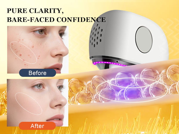 Purple & Blue Light – Clarify the Epidermis
