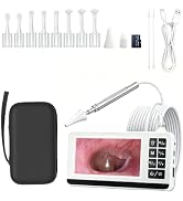 Digital Otoscope with 4.5" HD Screen, Visual Ear Wax Removal Tool with 32GB Card, 3.9mm Ear Camer...