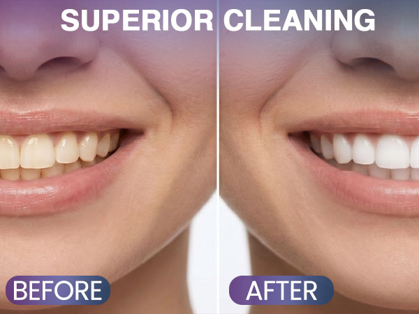 Superioe Cleaning Floss Drops Grapes